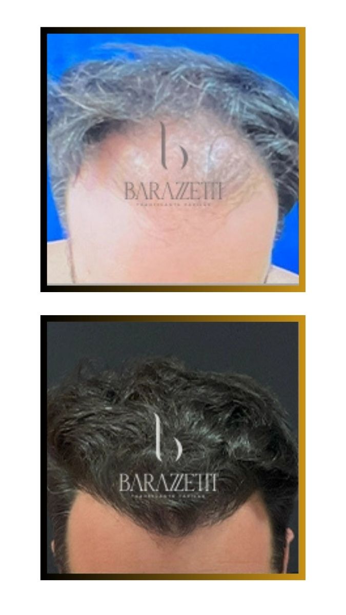 Antes e depois